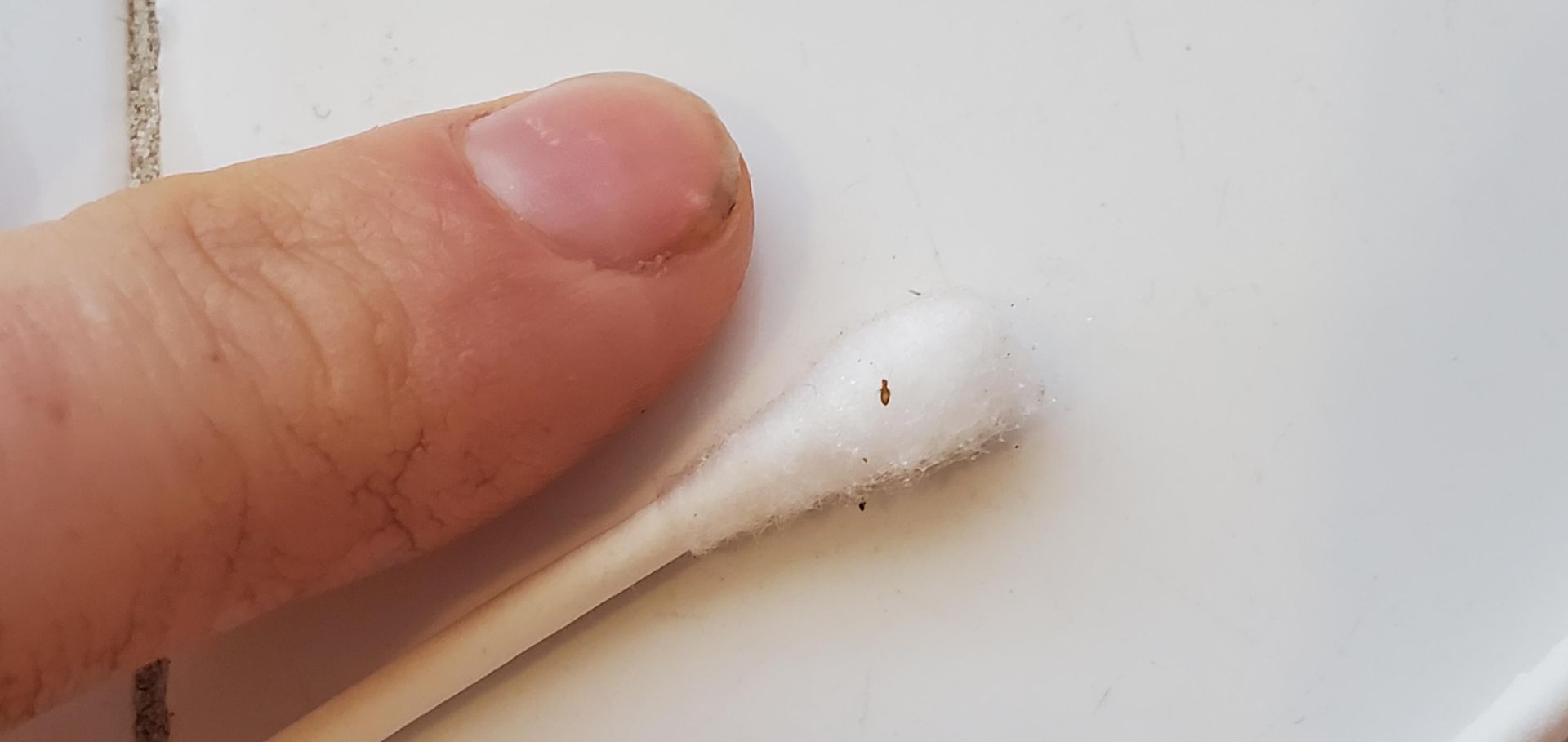 مكافحة حشرة الرطوبة عمان الاردن