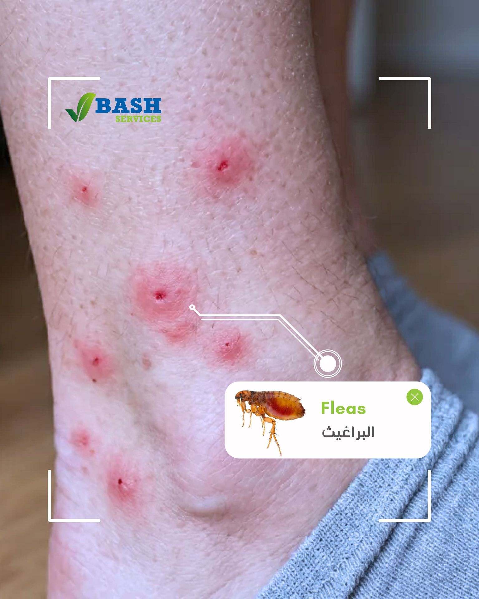 قرصات و لدغات البراغيث