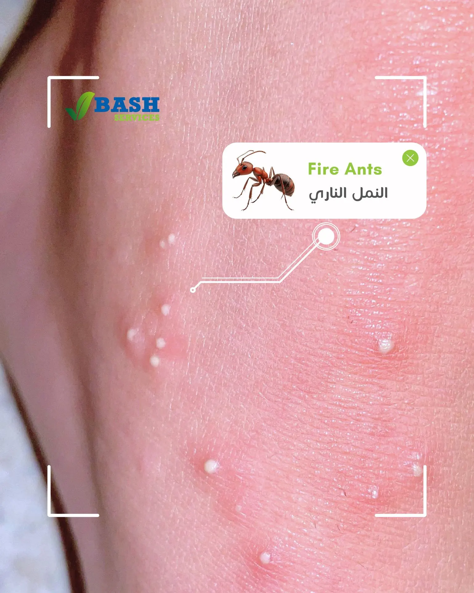 قرصات و لدغات النمل